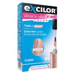 EXCILOR - Solution Forte Color - Traitement Mycose de l'ongle - Vernis traitant 30 ml (Dispositif médical)  +  vernis à ongles nude cosmétique 8 ml