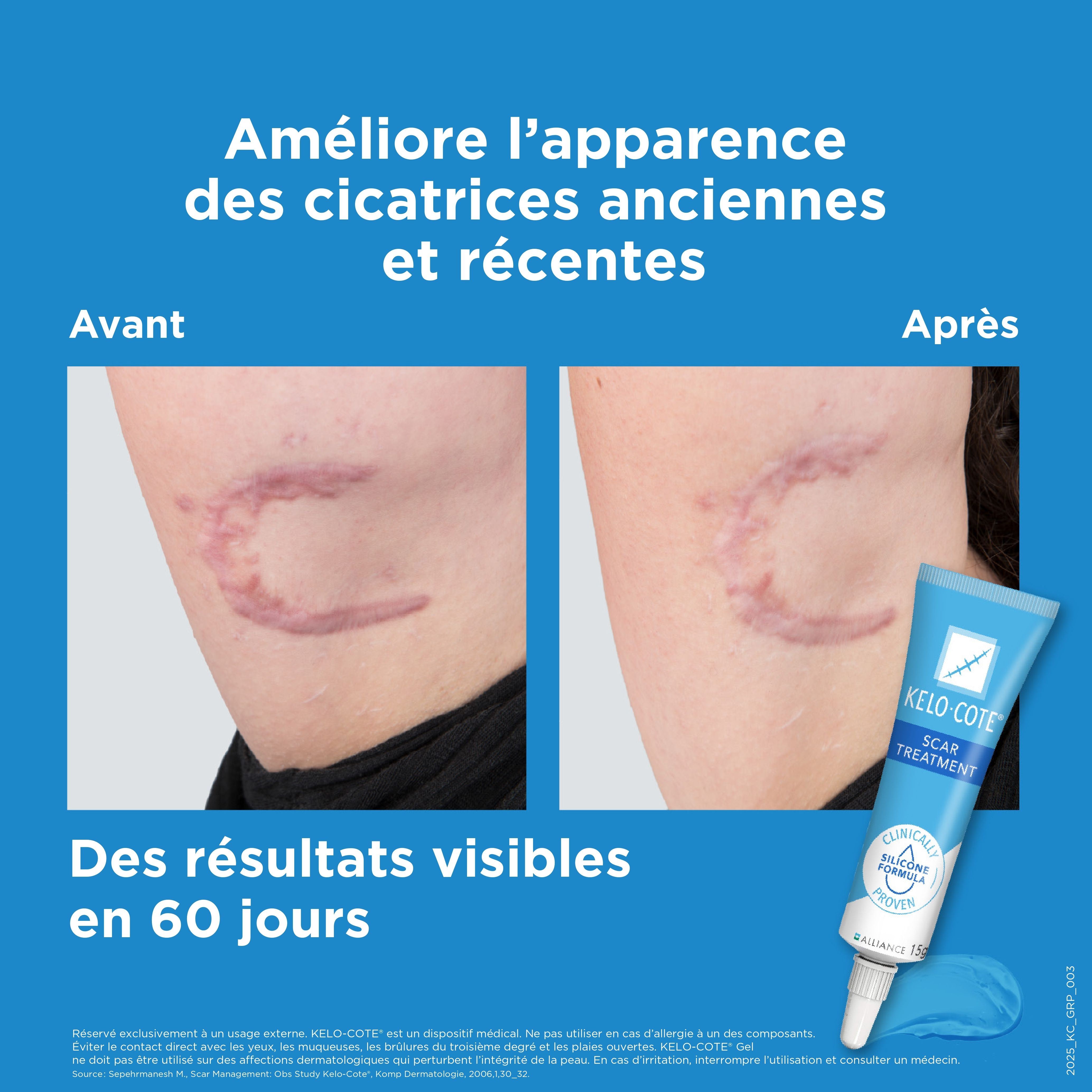 KELO-COTE® Gel pour cicatrices