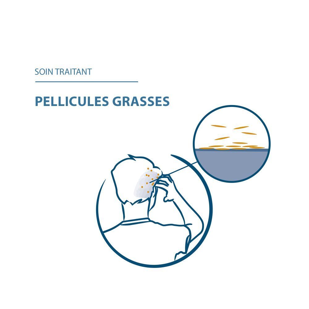 Ducray Squanorm Shampooing traitant antipelliculaire Pellicules grasses