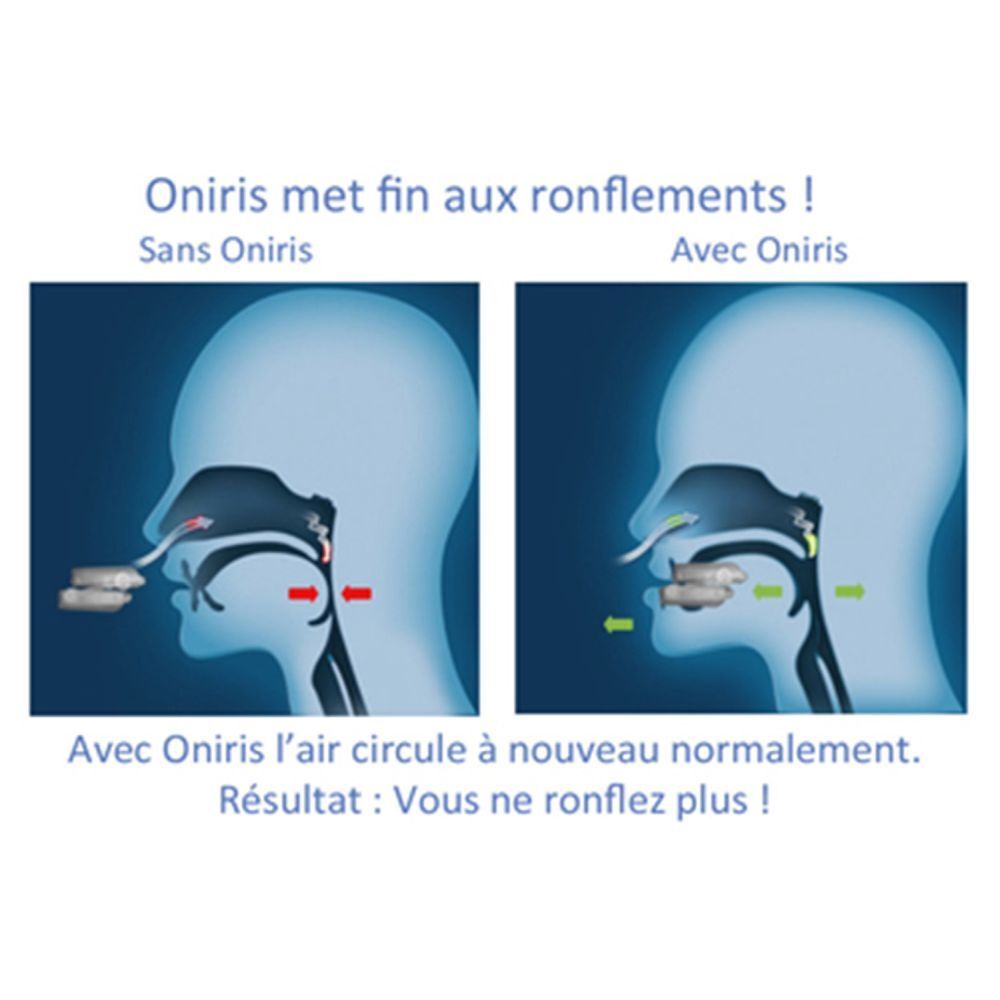 Emballage du produit Oniris. Texte: Ronflement et apnée du sommeil. Avec image de personnes dormant.