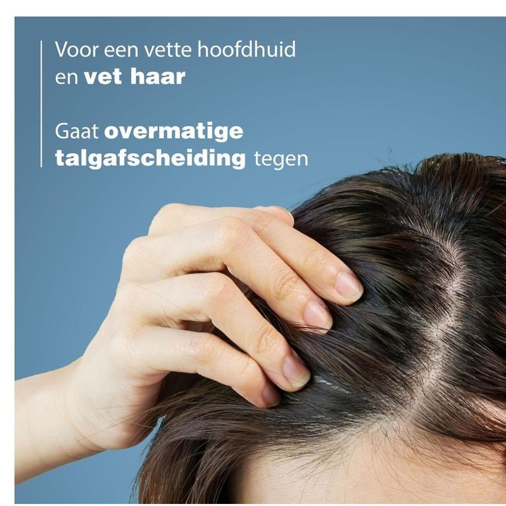 Gros plan d'une main sur un cuir chevelu gras. Texte: Contre la sécrétion excessive de sébum.
