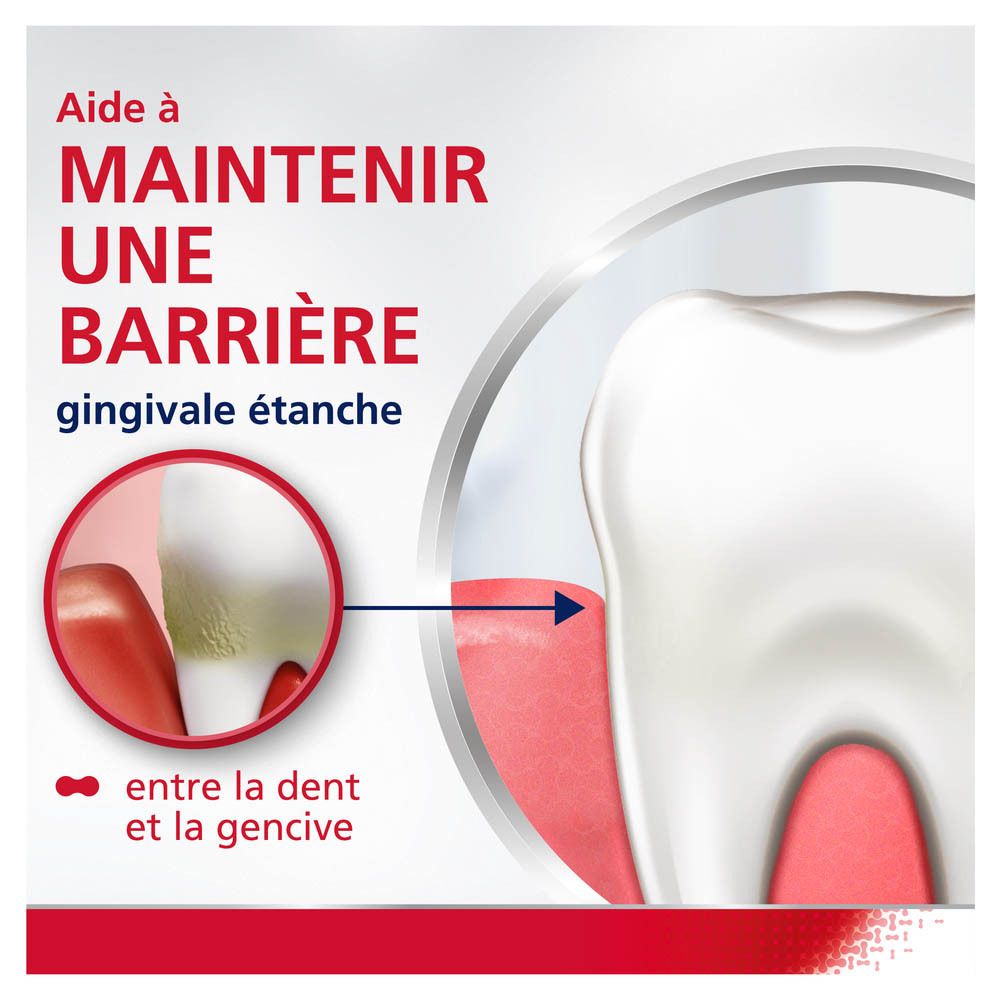 Graphique avec gencive. Aide à maintenir une barrière gingivale étanche.