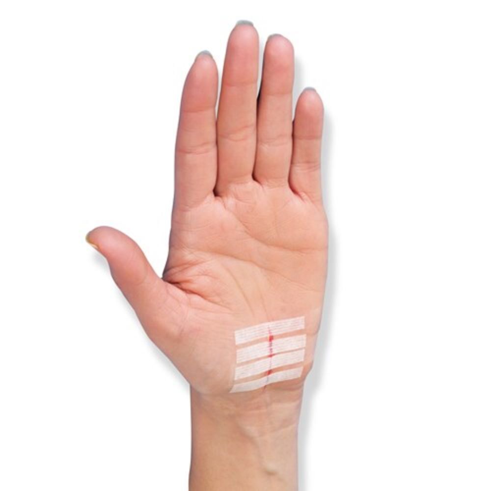 Nexcare™ Steri-Strip™ Suture Cutanée Blanche