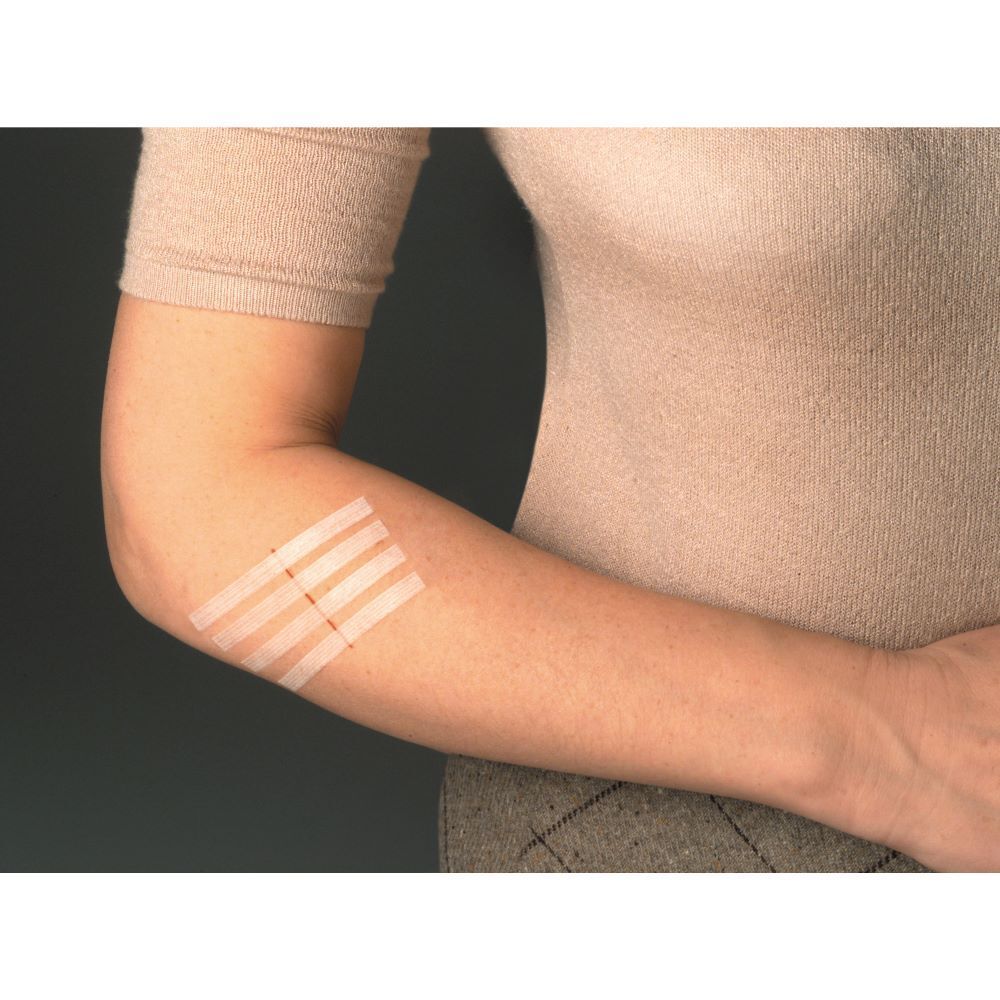 Nexcare™ Steri-Strip™ Suture Cutanée Blanche