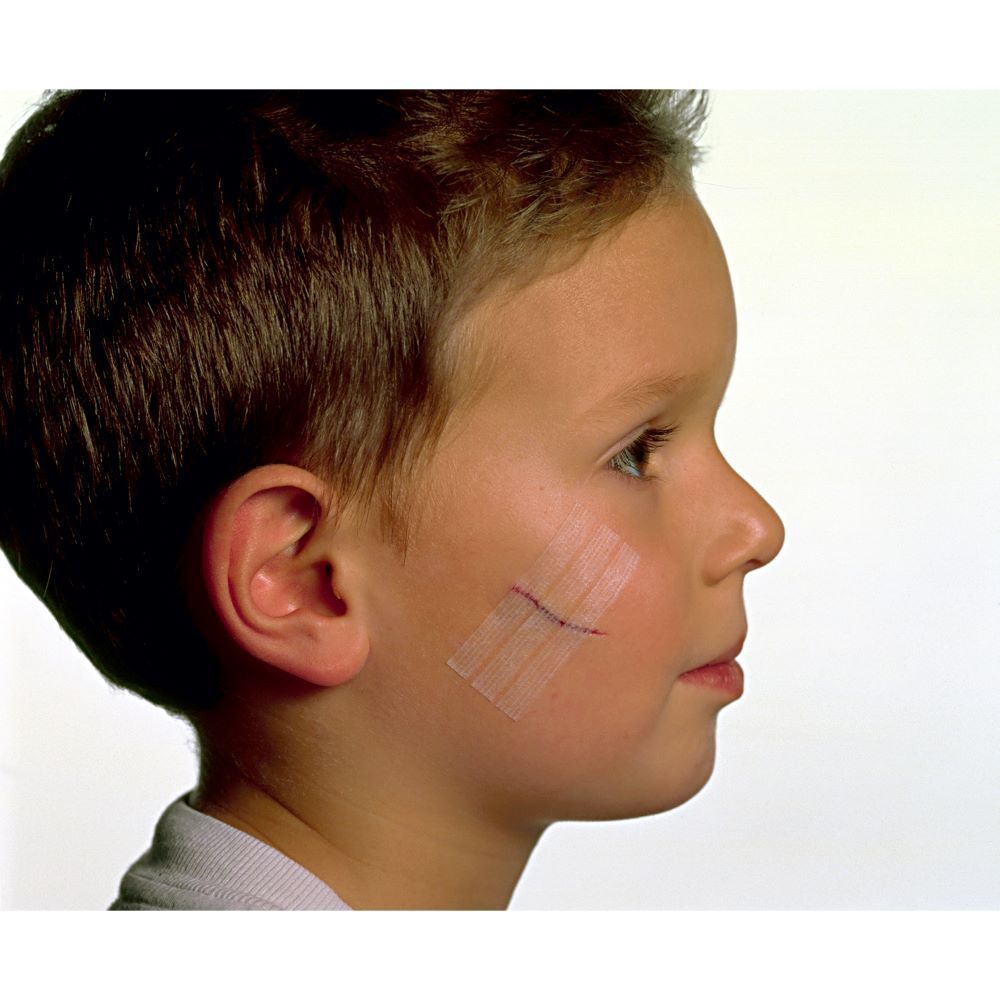 Nexcare™ Steri-Strip™ Suture Cutanée Blanche