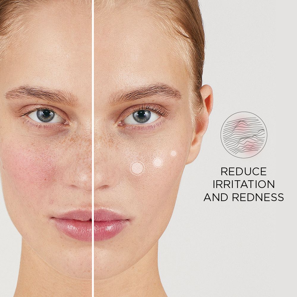 Moitié de visage avec rougeur, autre sans. Texte : Reduce Irritation and Redness.