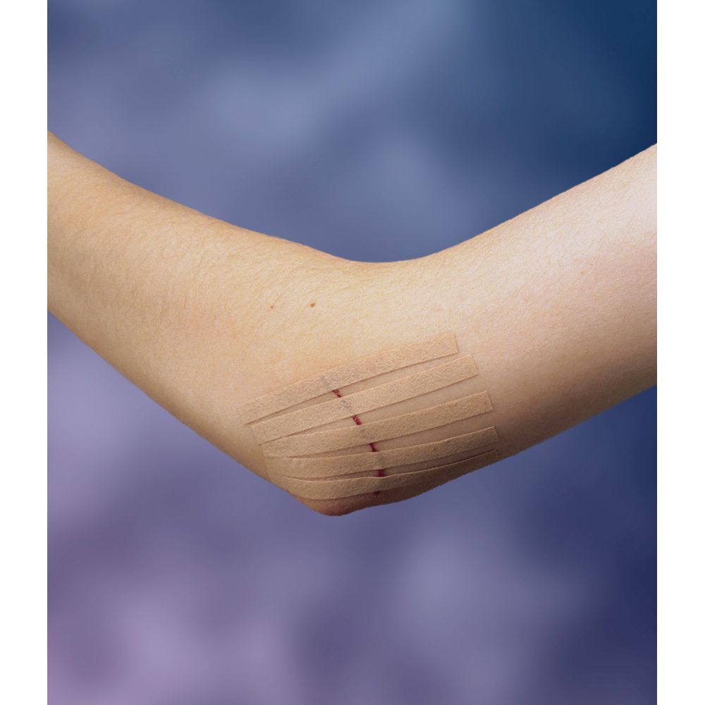 Nexcare Steri-Strip. Fermetures cutanées. Boîte de 6. Couleur chair. 6 mm x 75 mm. Logo 3M.