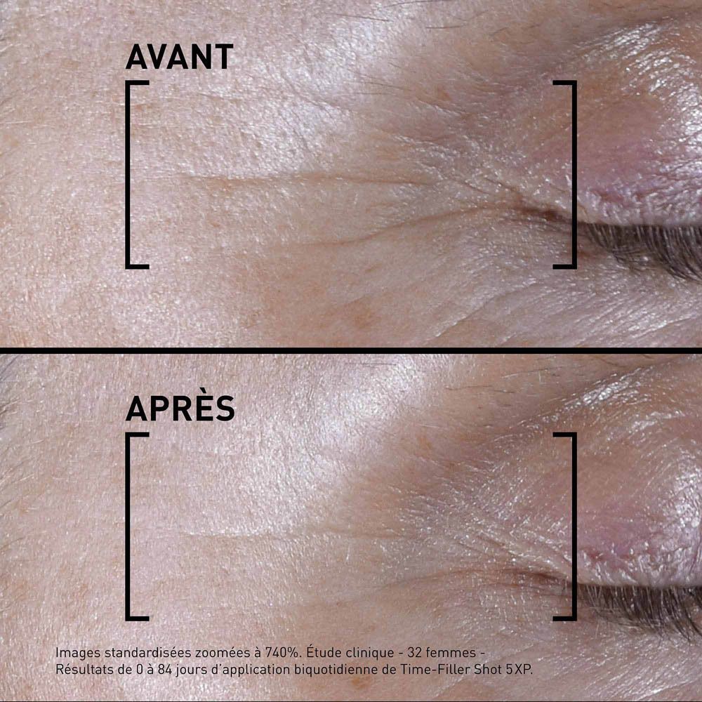 Image avant-après. Contour des yeux avec rides. Après 84 jours d'utilisation de Time-Filler Shot 5XP. Étude clinique.