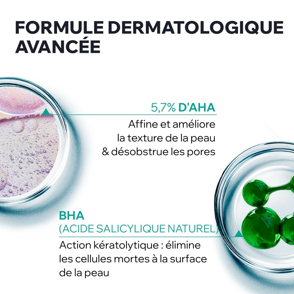 Uriage Hyseac Gel SOS : Gros plan d'un visage avec imperfections. "Peaux grasses sujettes aux imperfections".