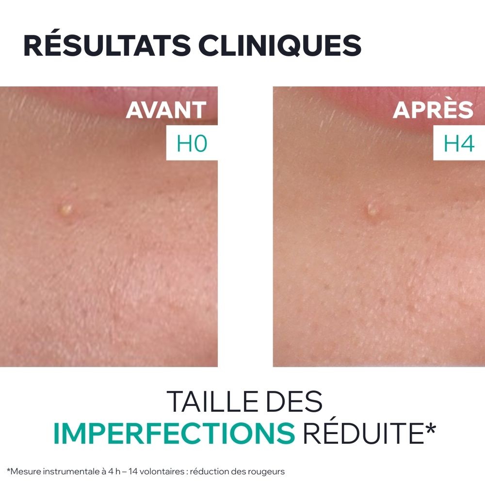 Uriage Hyseac Gel SOS : Appareils de laboratoire avec liquides. "Formule dermatologique avancée". Contient AHA et BHA.