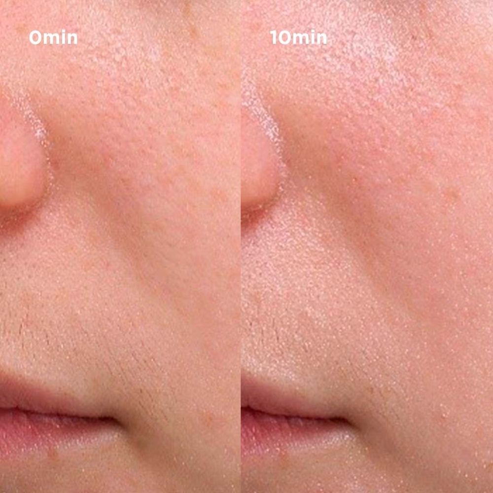 Peau avant et après application. Comparaison.