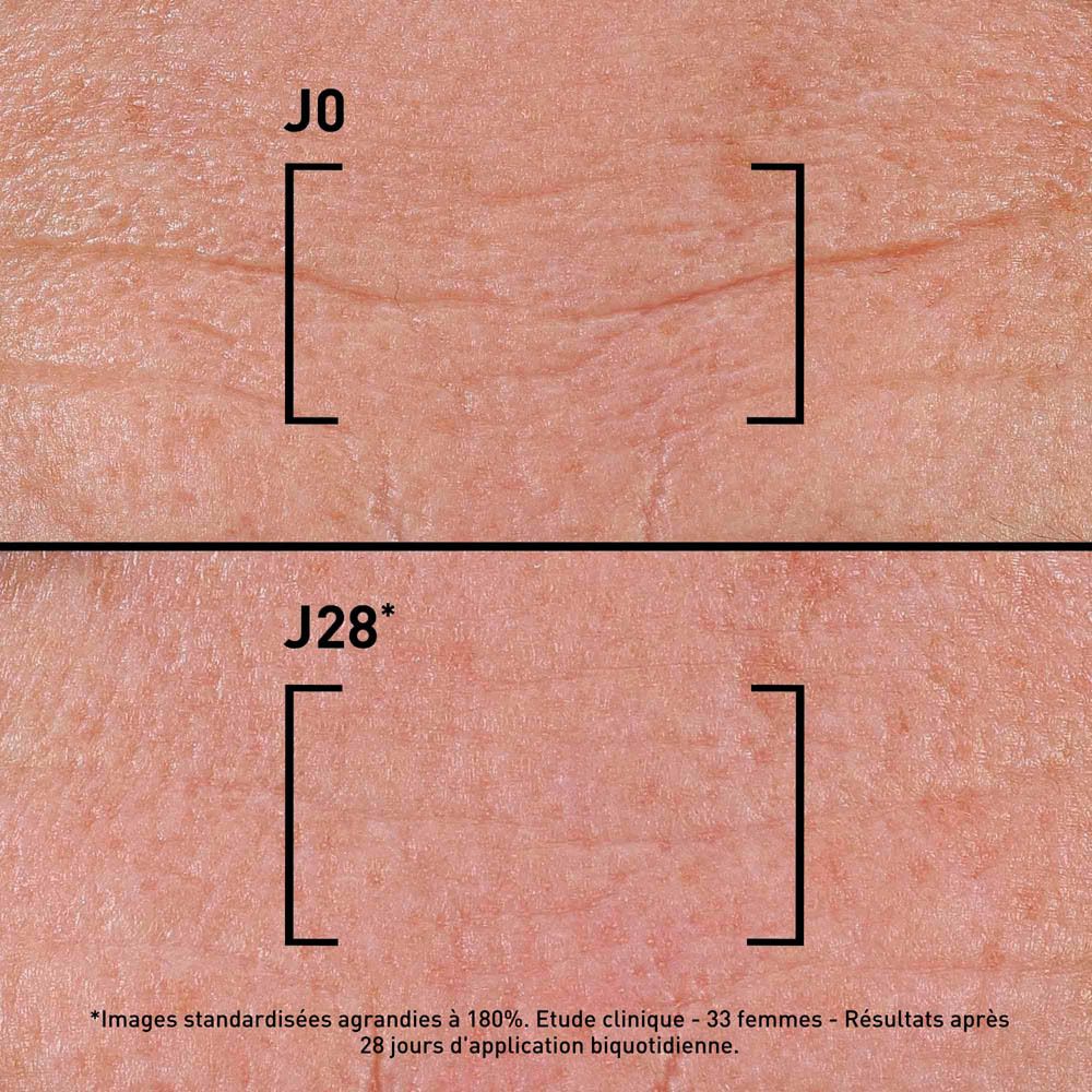 Peau avant et après 28 jours. Comparaison des rides. Texte: J0, J28, Etude clinique.