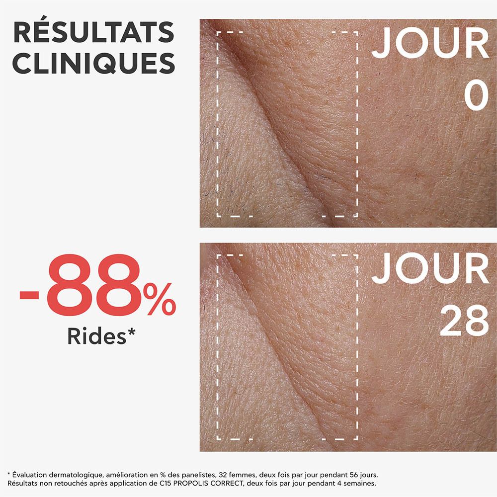Images comparatives des rides. Résultats après 28 jours. Marque : Apivita. Réduction des rides.