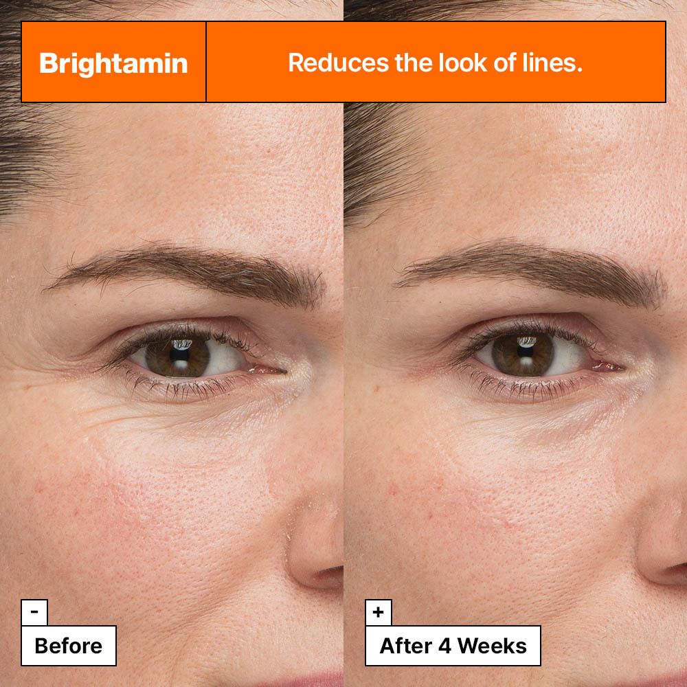 Comparaison avant-après de moitiés de visage. Texte : Brightamin réduit l'apparence des rides. Après 4 semaines.