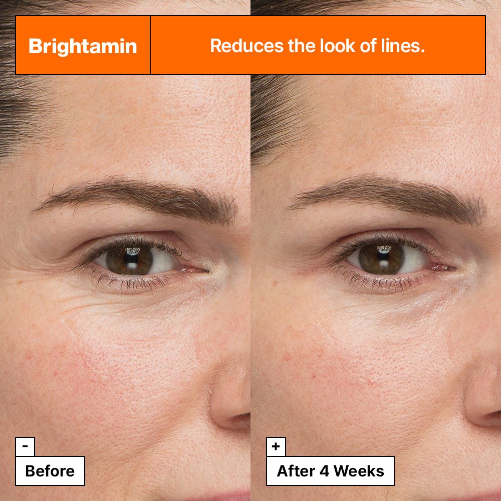 Comparaison avant-après de moitiés de visage. Texte : Brightamin réduit l'apparence des rides. Après 4 semaines.