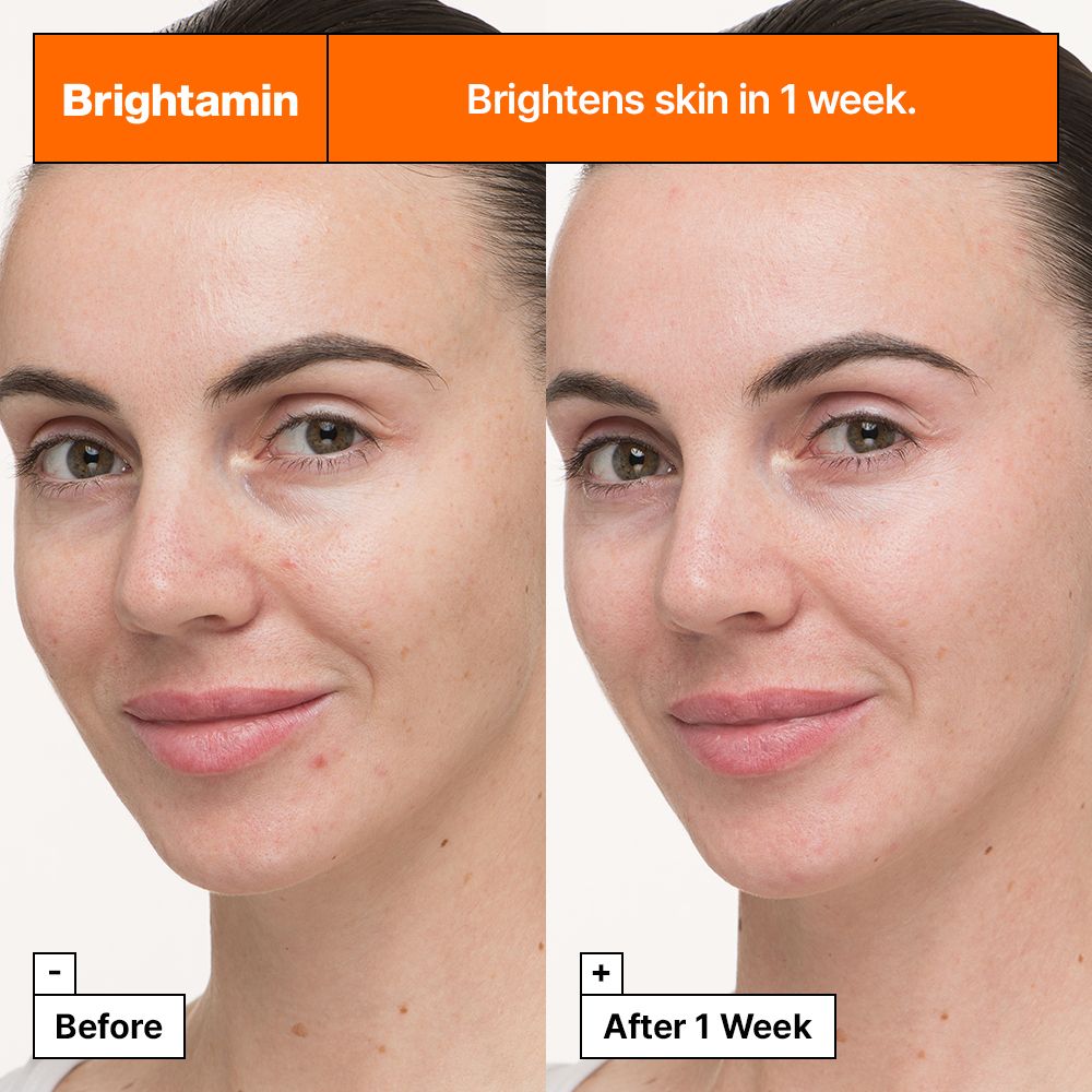 Comparaison avant-après de visages. Texte : Brightamin illumine la peau en 1 semaine.