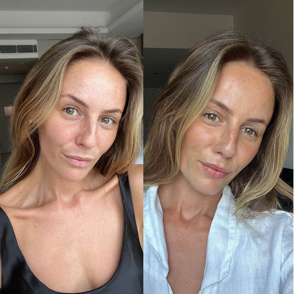 Visage d'une femme. Effet avant-après. Le teint est amélioré par les Bronzing Drops.