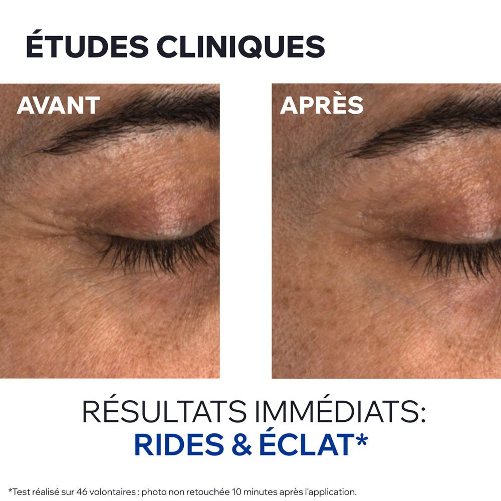 Comparaison avant-après des yeux. Texte: Résultats immédiats: rides & éclat.