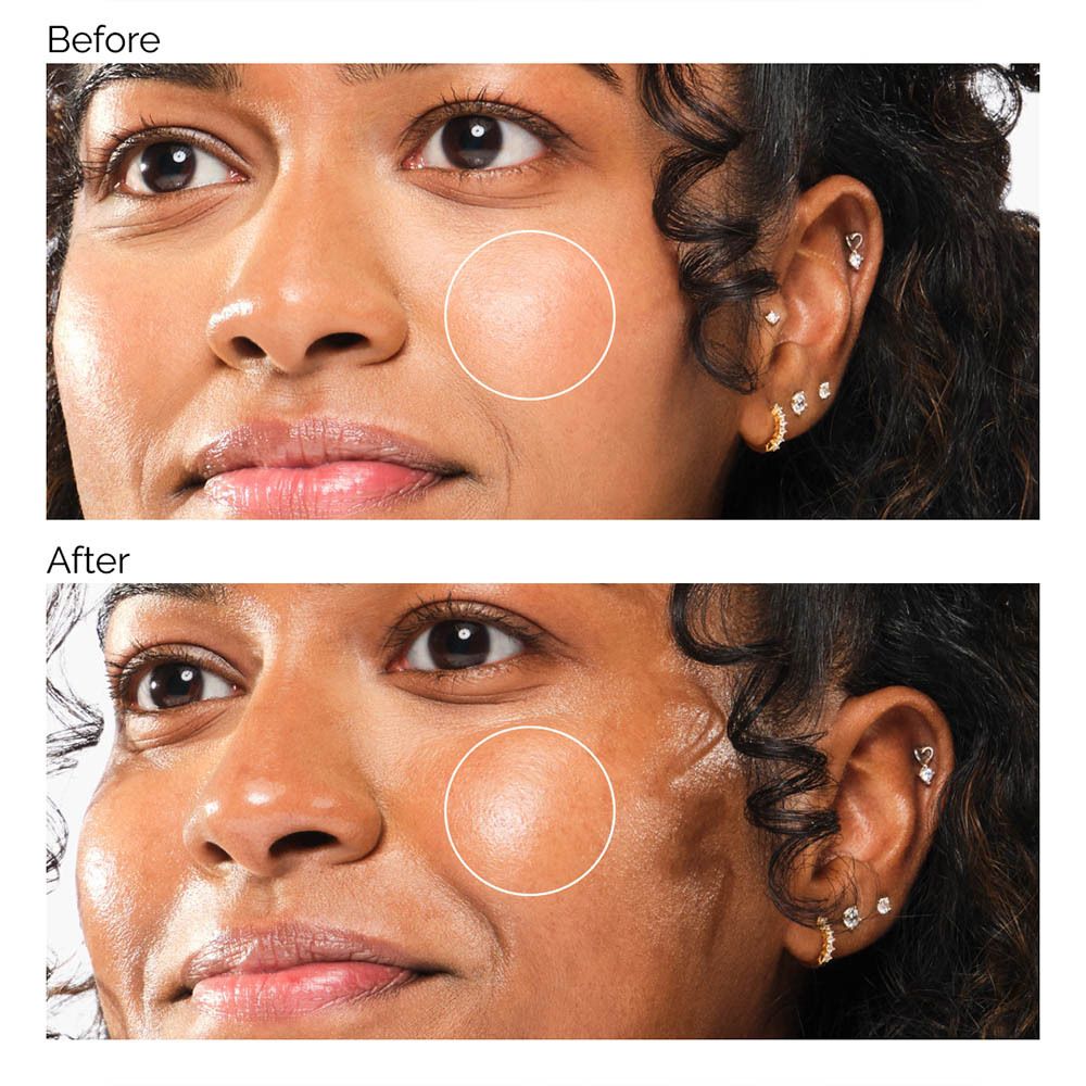 Image avant-après. Visage avec imperfections. Après : peau plus lisse.
