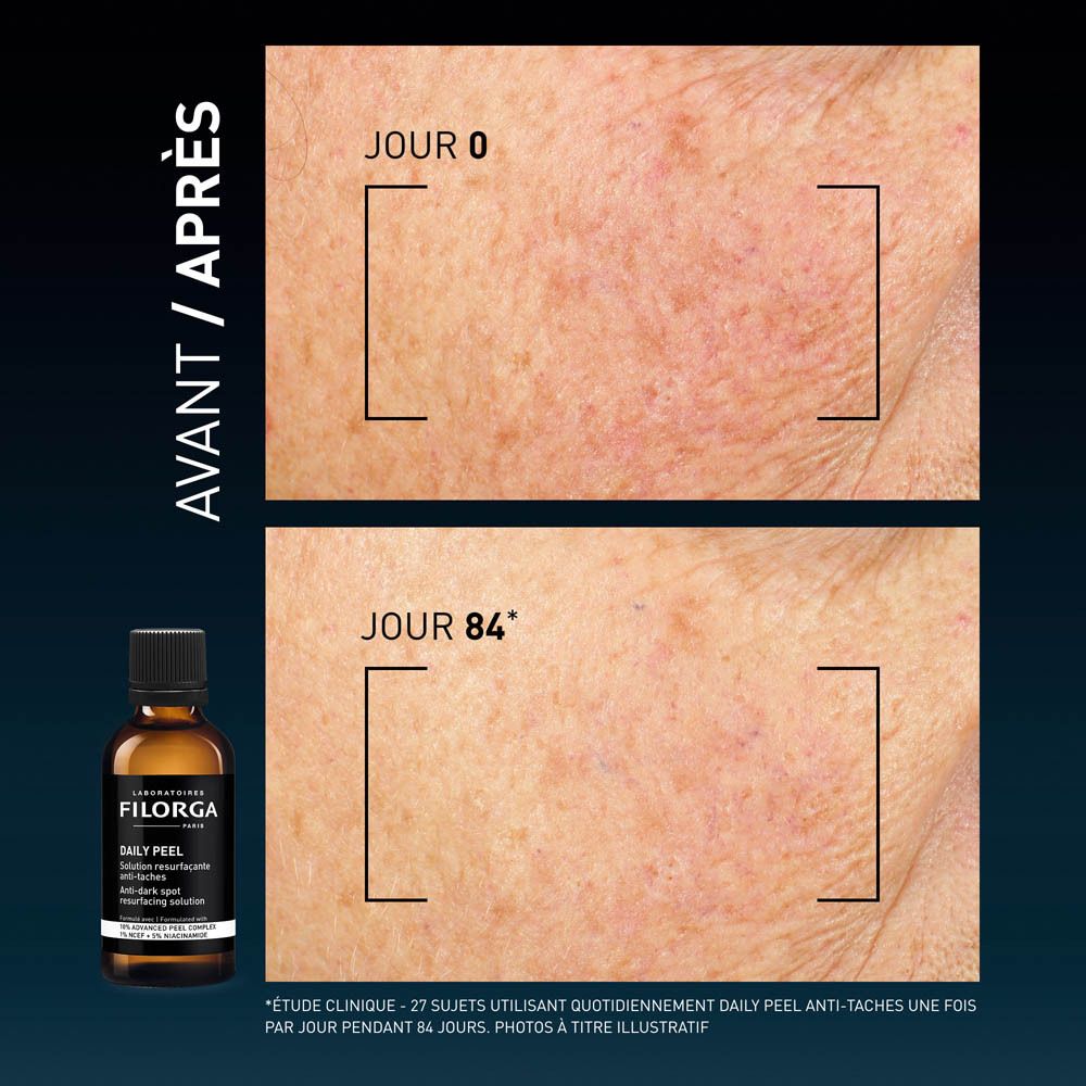 Comparaison avant-après. Images de peau. Flacon Filorga DAILY PEEL.