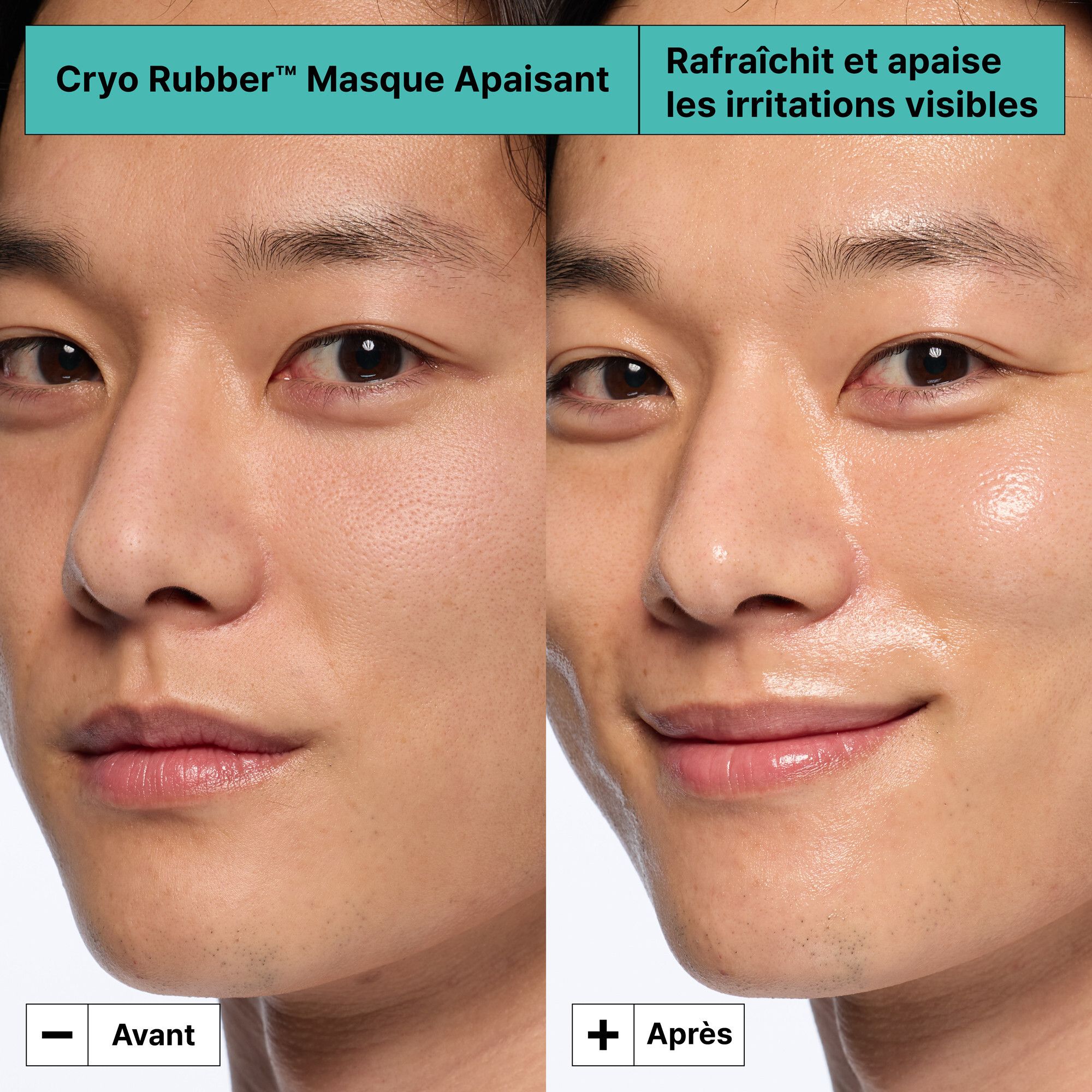 Comparaison avant-après. Visage d'un homme. Gauche : peau avant utilisation. Droite : peau après utilisation.