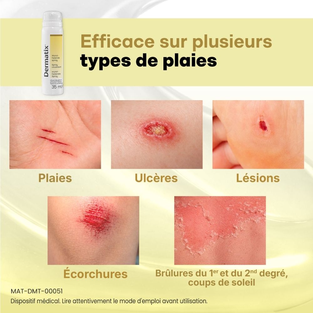 Dermatix Spray Cicatrisant: Enfant avec une blessure au genou, montre une cicatrisation 4x plus rapide.