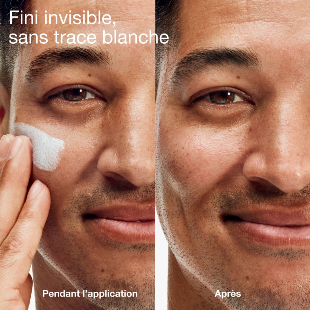 Homme appliquant de la crème. Comparaison avant/après.