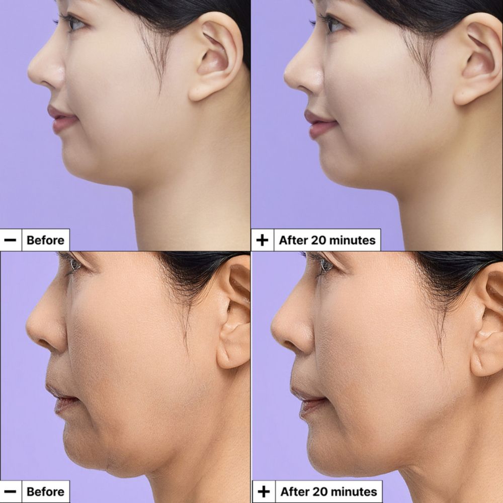 Comparaison avant-après de la mâchoire d'une femme après utilisation du masque lifting Dr. Jart+ Cryo-V.
