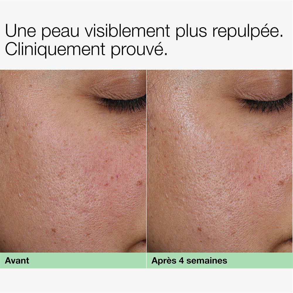 Gros plan de zones de peau montrant l'efficacité du collagène, des peptides et du PDRN pour l'élasticité et la fermeté de la peau.