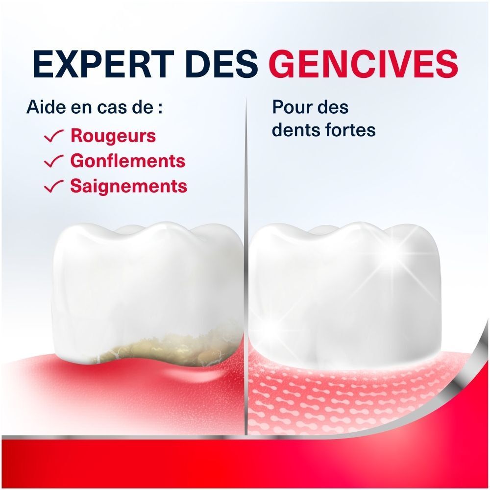 Comparaison de gencives saines et enflammées, avec texte sur l'expertise gencives.