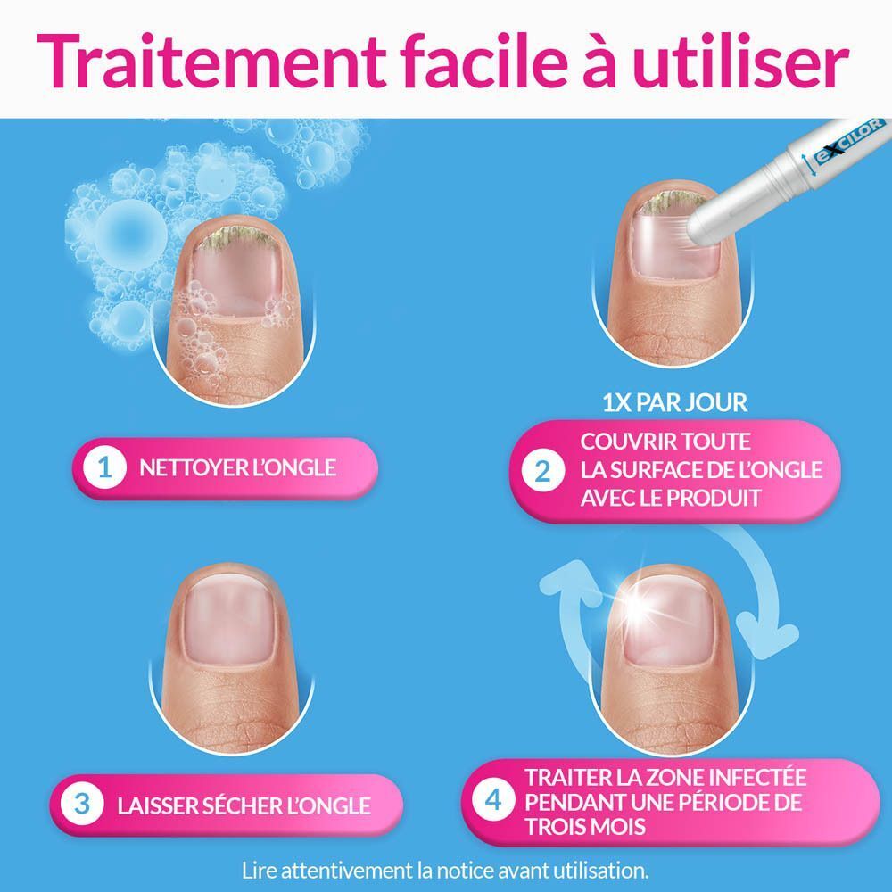 Illustration de la mycose de l'ongle. Texte: Technologie TransActive. Pénétration rapide.