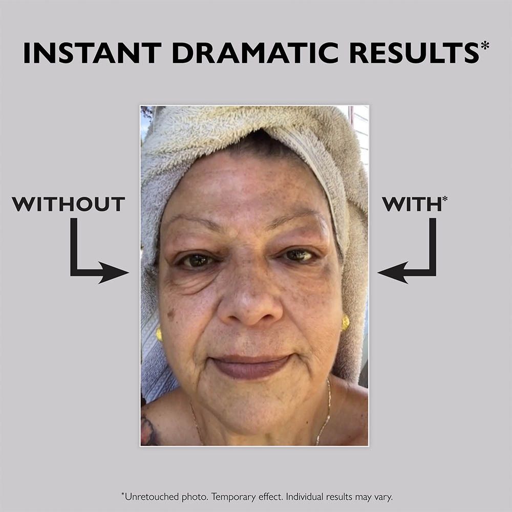 Visage d'une femme avec comparaison avant-après. Contour des yeux. Sans produit.