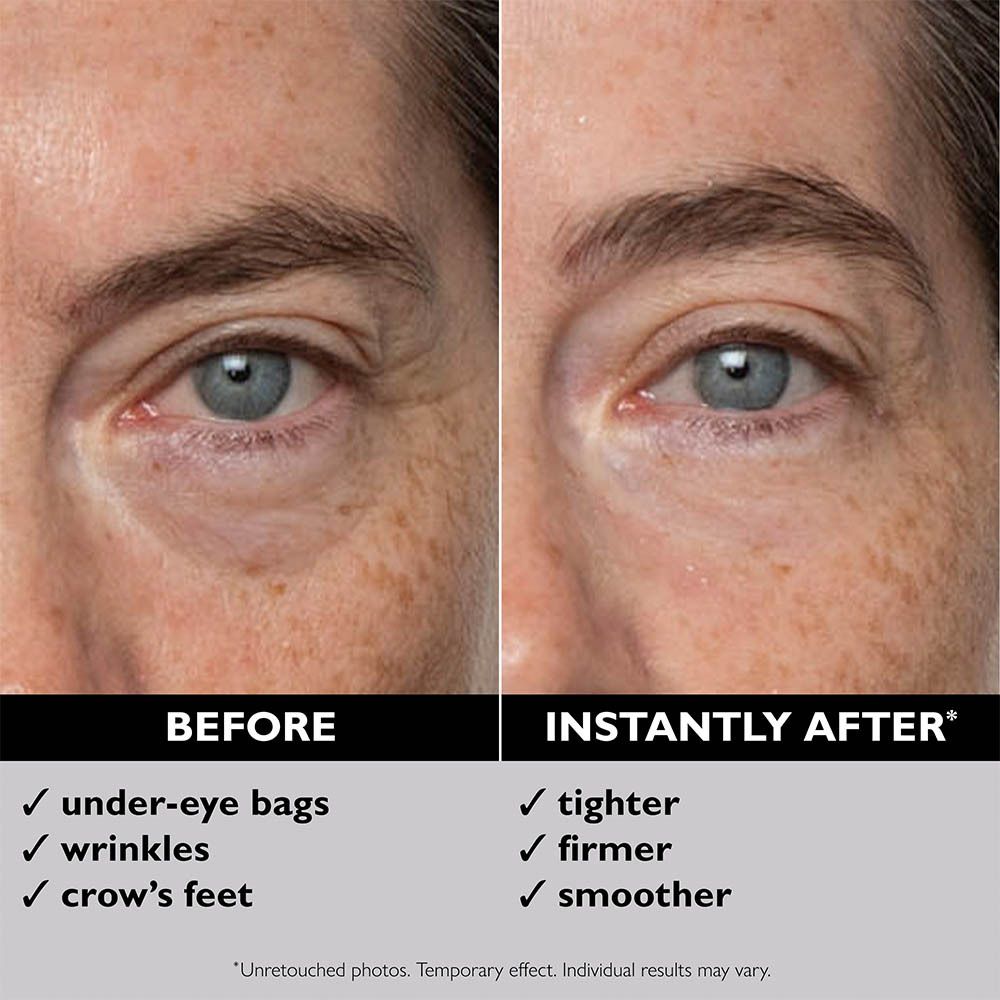 Contour des yeux avec comparaison avant-après. Texte : Avant, Immédiatement après. Sans produit.
