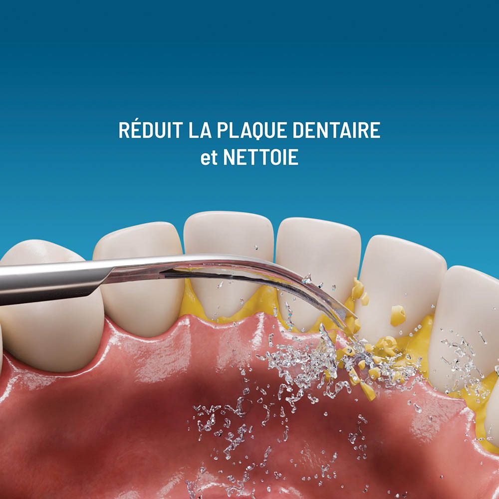 Gros plan : nettoyage des dents avec la brosse à dents Haepi-Julia. Élimination du tartre.