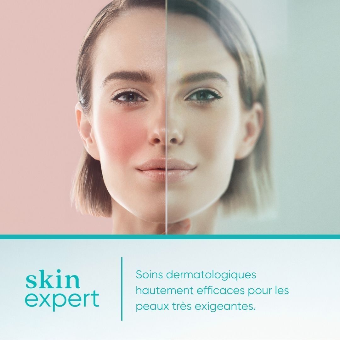 Visage d'une femme divisé en deux. Un côté rouge, l'autre normal. Texte : skin expert.