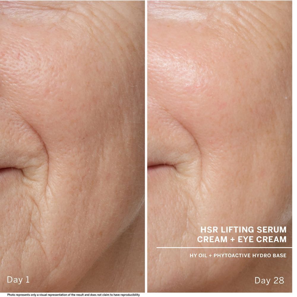 Comparaison avant-après de la peau. Texte : HSR Lifting Serum Cream + Eye Cream. Jour 1 et Jour 28.