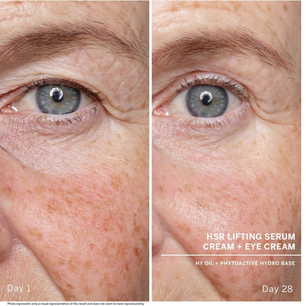Comparaison avant-après de la peau. Texte : HSR Lifting Serum Cream + Eye Cream. Jour 1 et Jour 28.