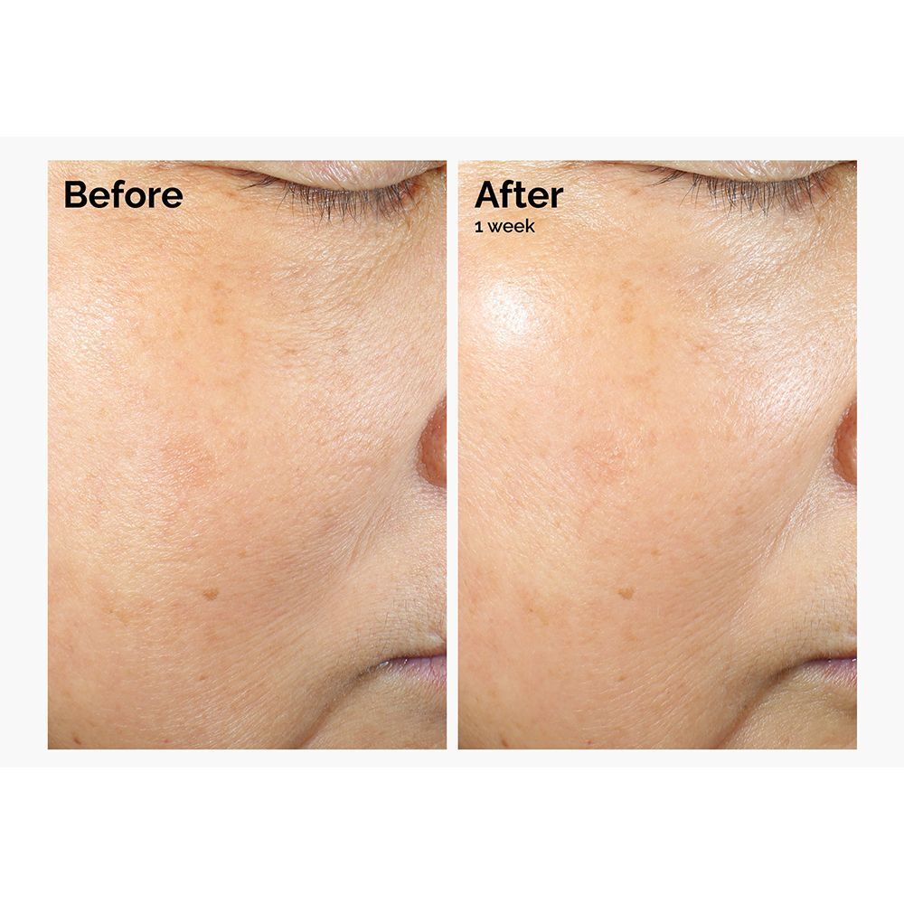 Comparaison avant-après de la peau après une semaine d'utilisation de The Ordinary Rice Lipids + Ectoin Microemulsion.