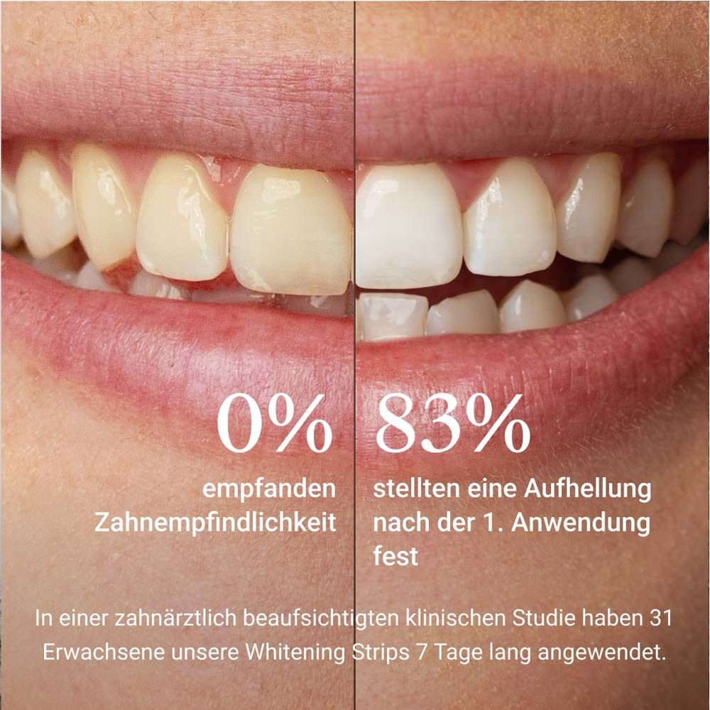 Comparaison : dents avant et après utilisation. 0% vs. 83% d'éclaircissement.