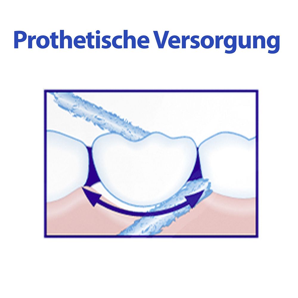 Illustration: Nettoyage sous prothèses. Flèches montrent le mouvement du fil sous la prothèse.