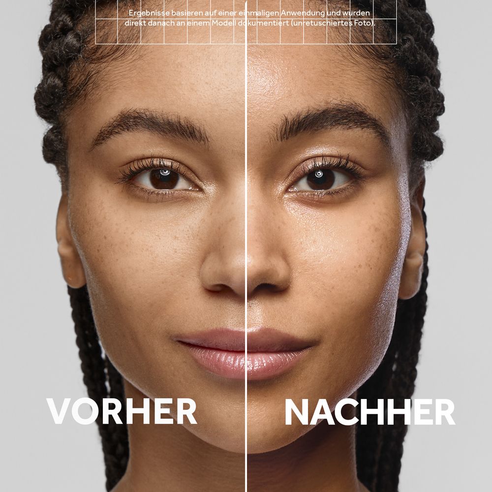 Comparaison avant-après d'un visage montrant l'effet d'un produit de soin de la peau.