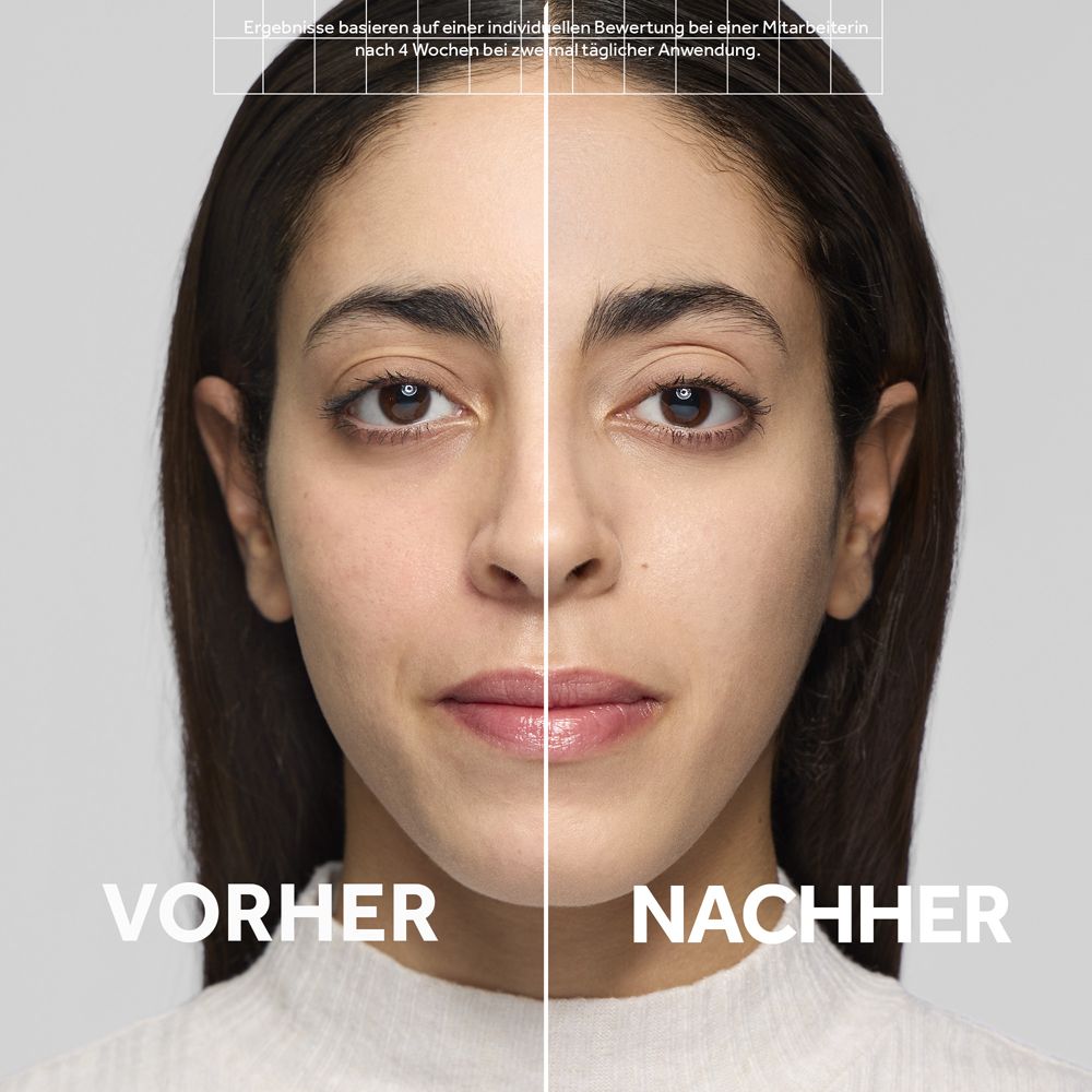 Comparaison avant-après d'une femme montrant une amélioration de la texture de la peau après utilisation de produits de soin.