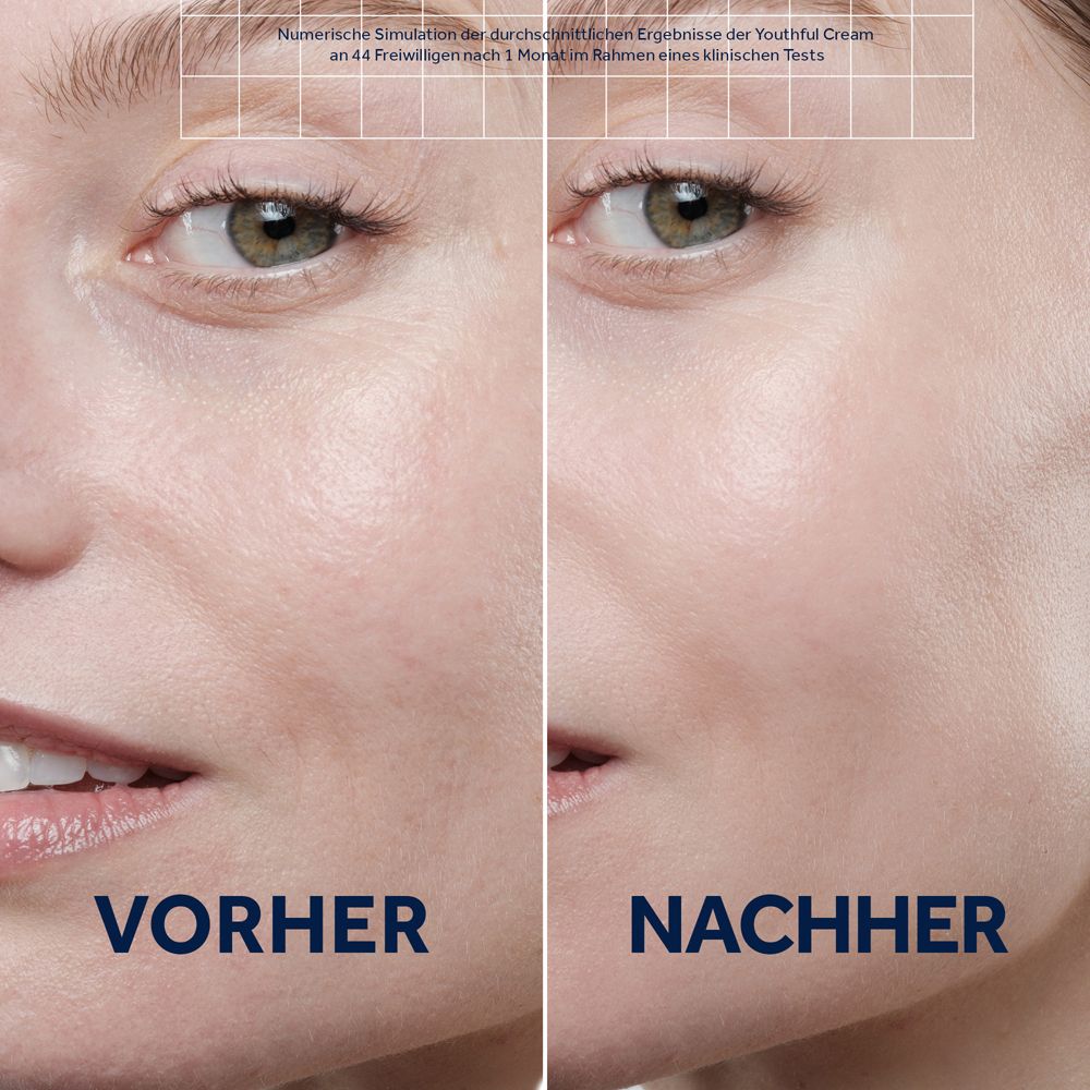 Comparaison avant-après. Moitiés de visage. Gauche : Avant. Droite : Après. Texte : Youthful Cream.