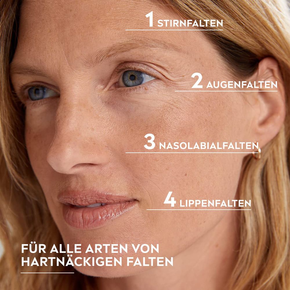 Visage d'une femme avec des marqueurs pour les rides du front, des yeux, nasolabiales et des lèvres.