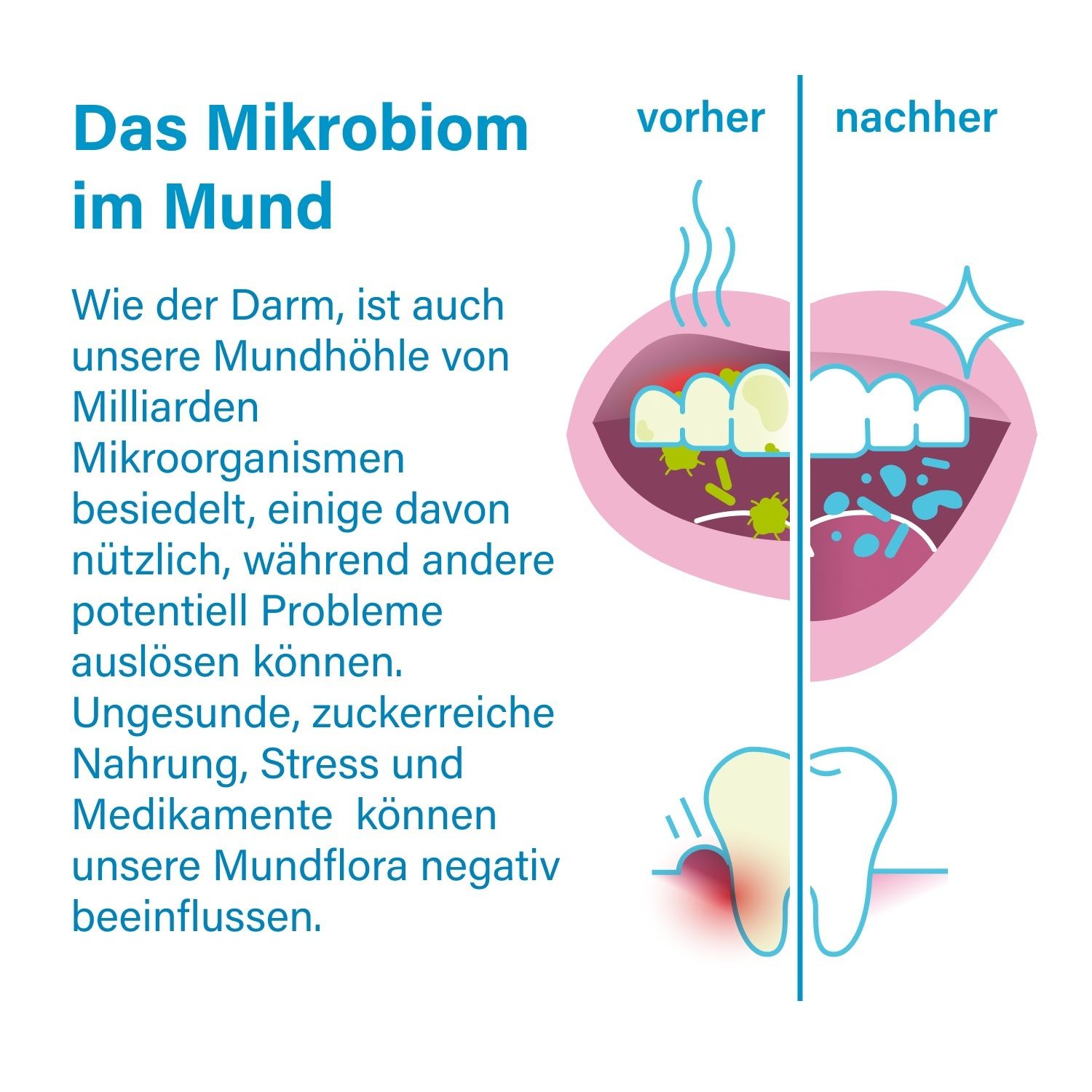 Illustration : cavité buccale avant et après utilisation. Texte : « Le microbiome dans la bouche ».