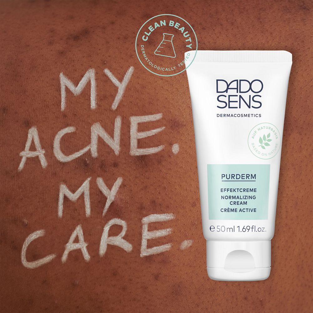 Tube avec produit et texte sur la peau. Texte : My Acne. My Care. Logo et nom du produit visibles.