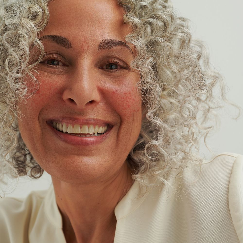 Femme aux cheveux gris et peau rouge. Sourit à la caméra.