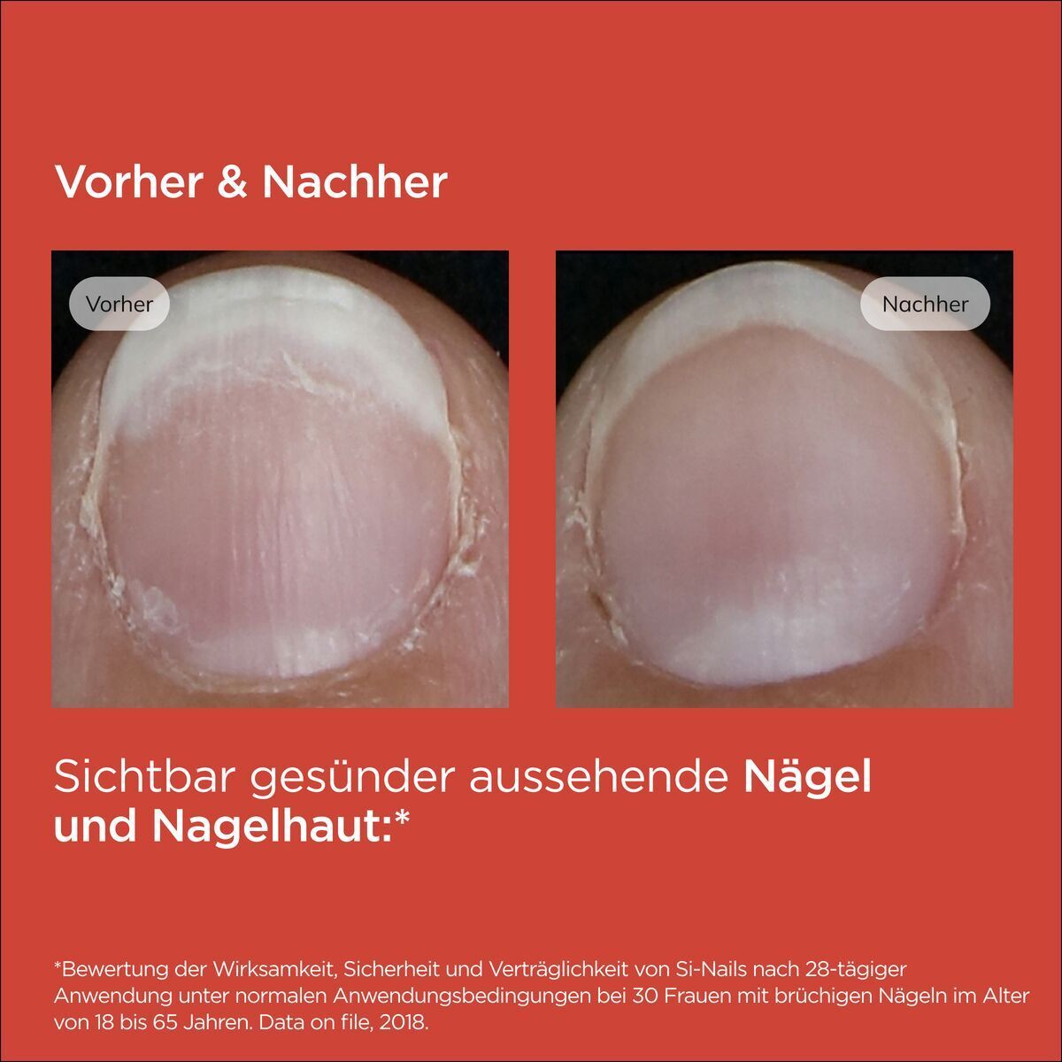 Comparaison avant-après des ongles. Texte : Ongles et cuticules d'apparence plus saine.