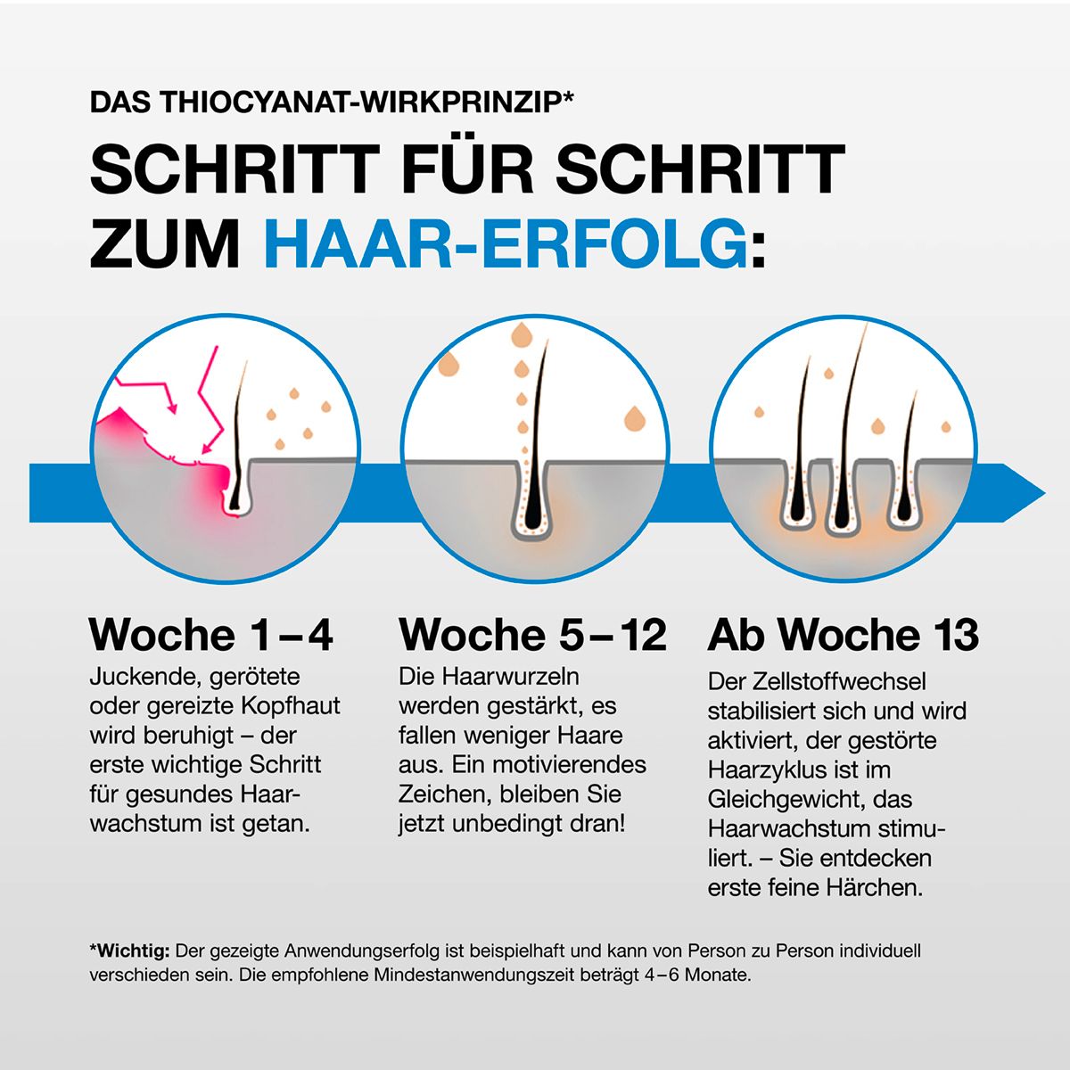 Graphique : Guide étape par étape pour la réussite capillaire. 3 phases : cuir chevelu qui démange, racines des cheveux, métabolisme cellulaire.