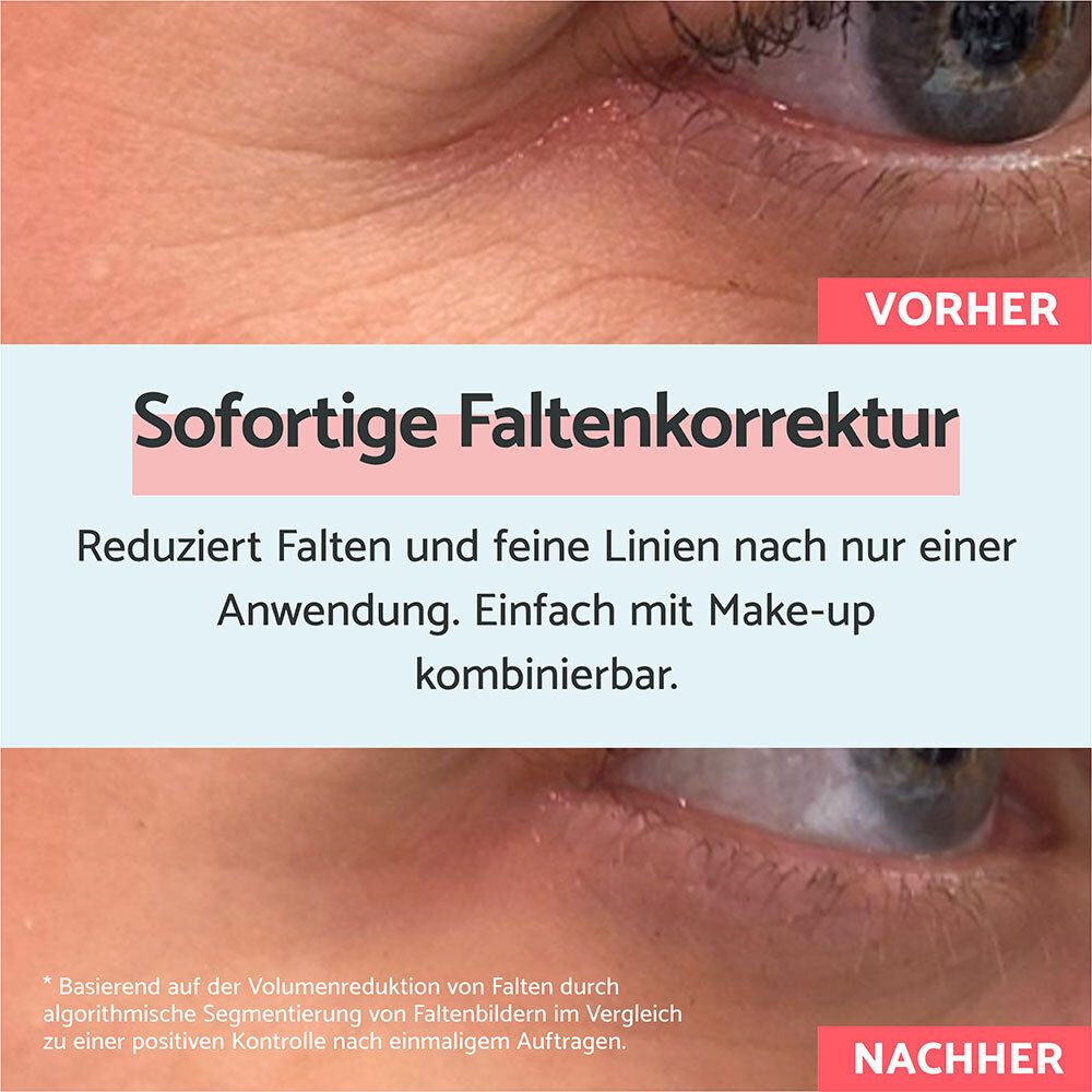 Comparaison avant-après de la zone oculaire montrant l'effet du Correcteur Rides Instantané Remescar.